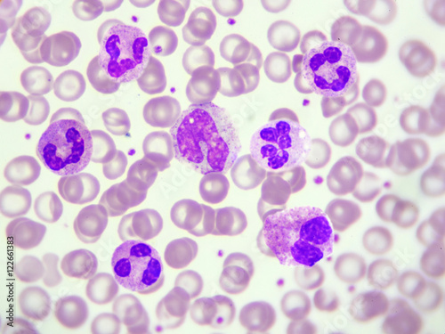 White blood cells in peripheral blood smear, Wright stain