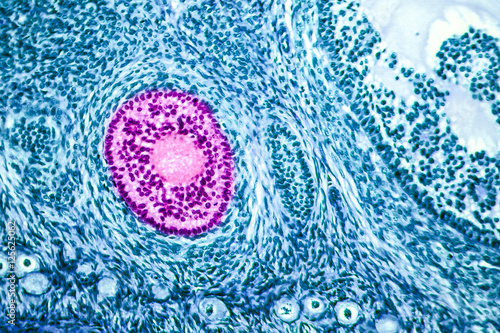 Ovarian follicles. Light microscopy, hematoxylin and eosin stain, magnification 200x. Colors are enhanced for better visualisation