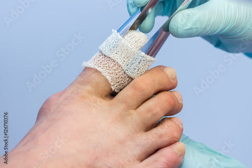 Fußpflege / Podologische Komplexbehandlung