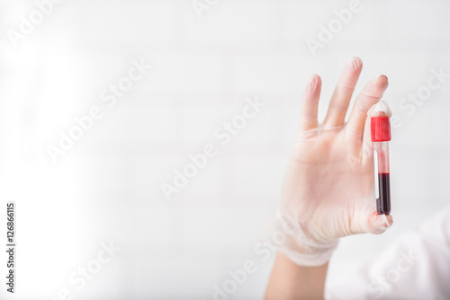 Scientist analyzing blood test tube