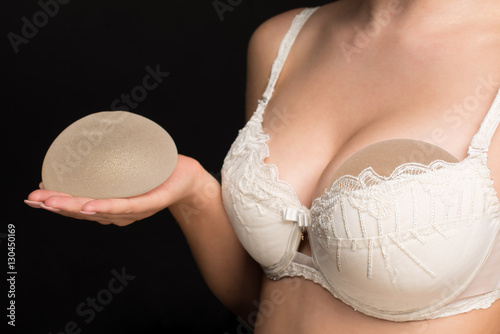 Silicone implants on hand and natural brest