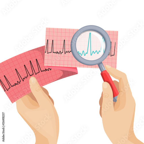 Look at atrial fibrillation through magnifying glass held by hand