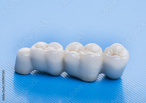 ceramic crowns - dental laboratory