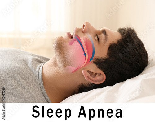 Snore problem concept. Illustration of obstructive sleep apnea