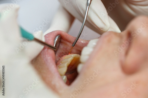 Dental laser used on a patient