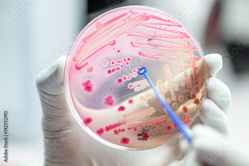 Close up the media plate on hand medical technicians working on bacterial culture and drug resistance of pathogens in laboratory.