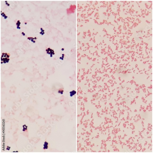 Smear of gram positive bacteria on the left and gram negative bacteria on the right, under 100X light microscope.