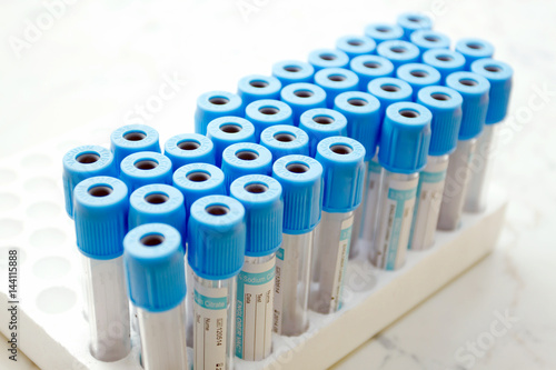 Test tubes for lab, isolated. Close-up of test tubes arranged on a tray in medical laboratory.