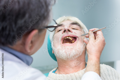 Senior man at dentist office. Person with bad teeth. Symptoms of caries.