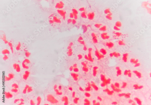 gram negative diplococci intracellular