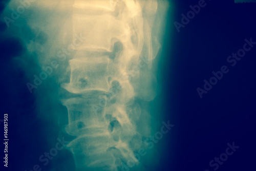 Close up spinal cord bone