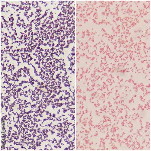 Smear of gram positive bacteria on the left and gram negative bacteria on the right, under 100X light microscope.