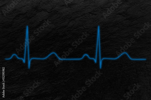 Electrocardiograma