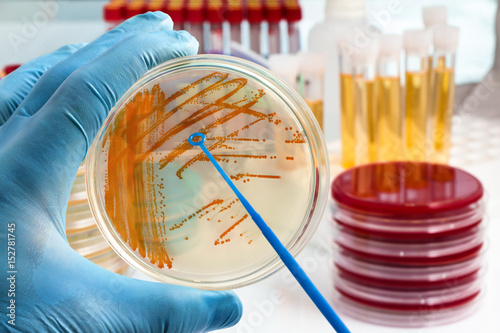 hand holding plate with bacterial colonies of Streptococcus agalactiae / Colonies of bacteria Streptococcus agalactiae in culture medium plate