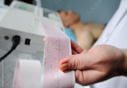 Electrocardiogram, ecg in hand. Clinic cardiology heart rhythm and pulse test closeup. Cardiogram printout.