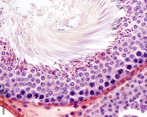 Seminiferous tubule. Epithelium