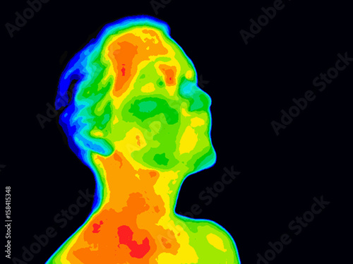 Thermographic image of human face and neck showing different temperatures in range of colors from blue cold to red hot. Red in neck might indicate raised CR-P levels and Carotid Artery inflammation.