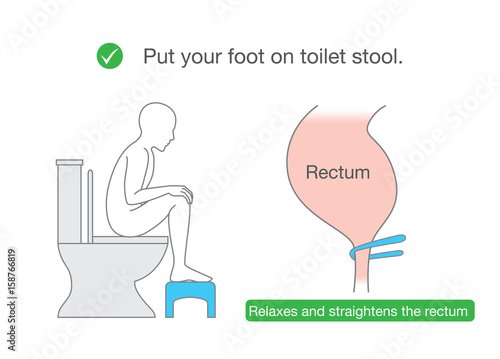 Put your foot on small benches while sitting on toilet for relax muscle and straightens the rectum. Illustration about Correct posture for healthy.