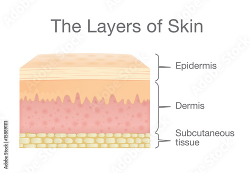 The Layer of Human Skin in vector style and components information. Illustration about medical and health.