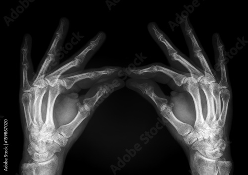 hands radiography