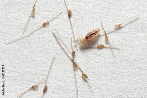 Louse and nits cocoons on white paper background