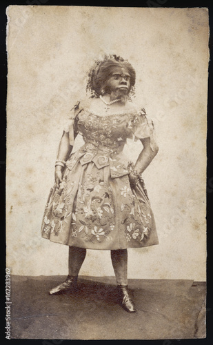 Julia Pastrana from Mexico hairy woman. Date: circa 1850