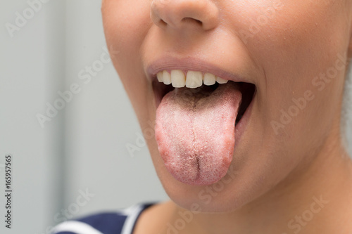 Girl showing her tongue out of mouth