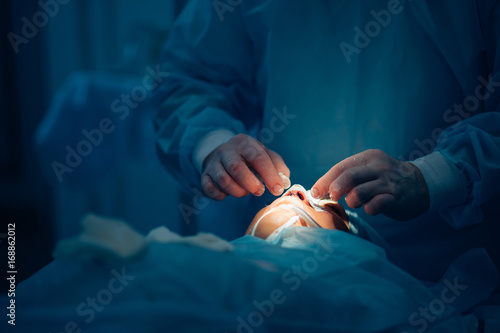 Surgeon wearing gloves operates women's nose . Operation close up.