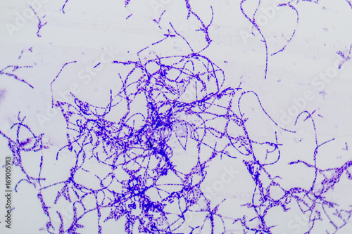 Bacillus is a genus of gram-positive, rod-shaped bacteria and a member of the phylum Firmicutes. 