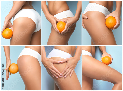 Collage of young woman with orange on color background. Cellulite problem concept
