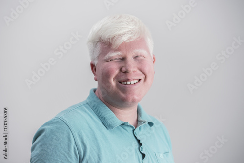 Albino young man portrait. Smiling man isolated at white background
