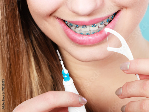 Woman with braces cleaning teeth with toothbrush