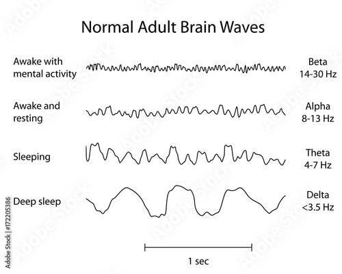 Normal Brain Waves EEG