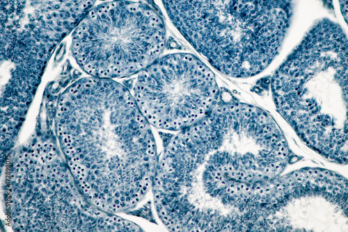 Cross section Human testis under microscope view.