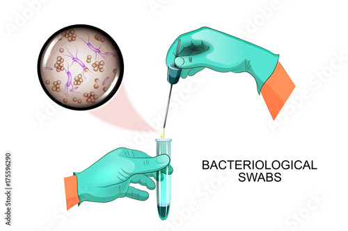 bacteriological swabs