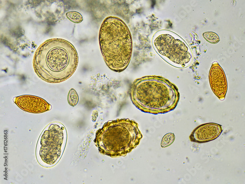 Eggs of helminthes in stool, analyze by microscope 