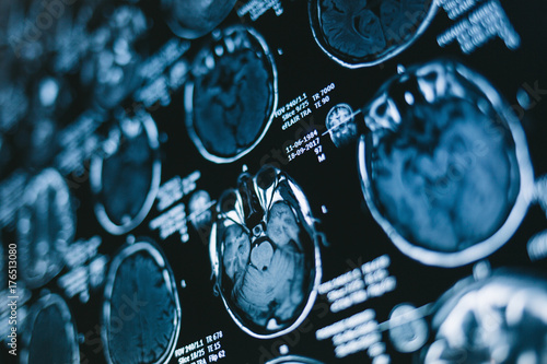 Magnetic resonance scan of the brain. Medicine, science 