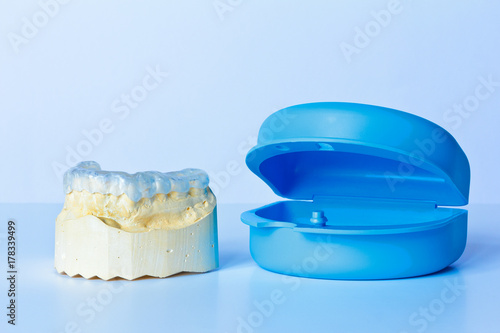 Grind guard made out of clear plastic on a custom-made tooth model, used against excessive wear caused by bruxisme