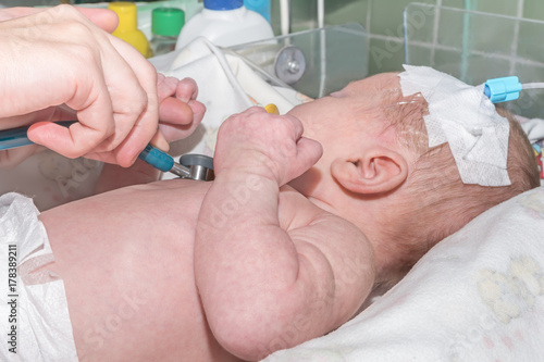 Doctor doing auscultation newborn baby with peripheral intravenous catheter in the vein of his head in neonatal intensive care unit