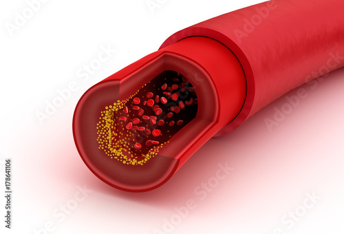 Blood vessel sliced macro with erythrocytes , Medically accurate 3D illustration