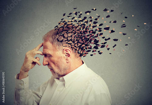 Memory loss due to dementia. Senior man losing parts of head as symbol of decreased mind function.