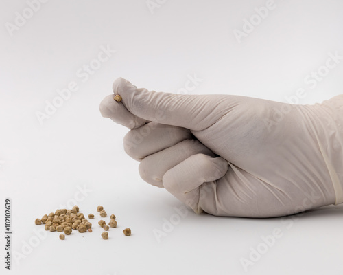 Arzt hält entnommene Gallensteine eines Patienten in der Hand und betrachtet diese