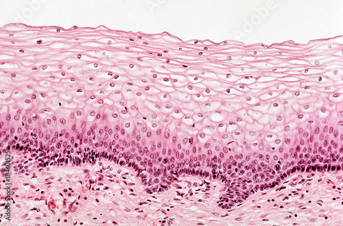 Ectocervical epithelium