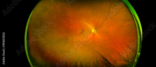 eye's retinal angle image with macula, vessels and optic disc isolated view on a black bacground. made by ultra wide fundus camera