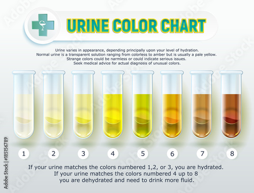 Urine Color Chart 1