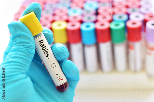 Blood sample positive with rabies virus