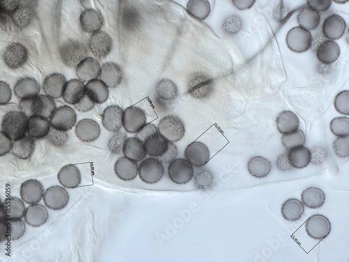 Spores of a slime mold, or myxomycete. High score microscopy. Slime moulds are special organisms that gather from many microscopic unicellular amoebae