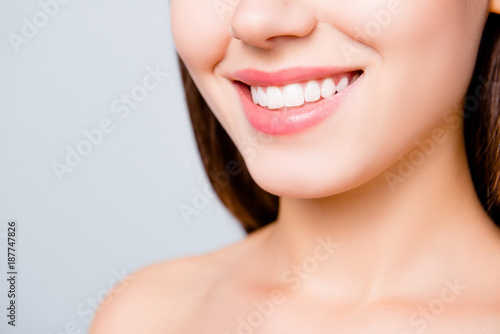 Close up portrait of beautiful wide smile with whitening teeth of young fresh woman isolated over white background, dental care