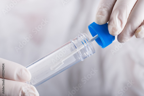 Hands in medical gloves holding empty plastic tube with blue cap for collection of stool analysis