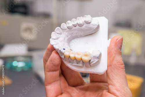 Technical shots of model on a dental prothetic laboratory